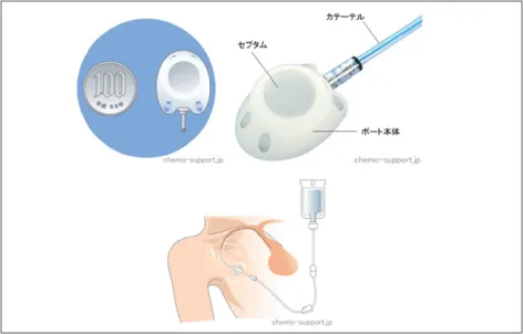 CV ポートとは