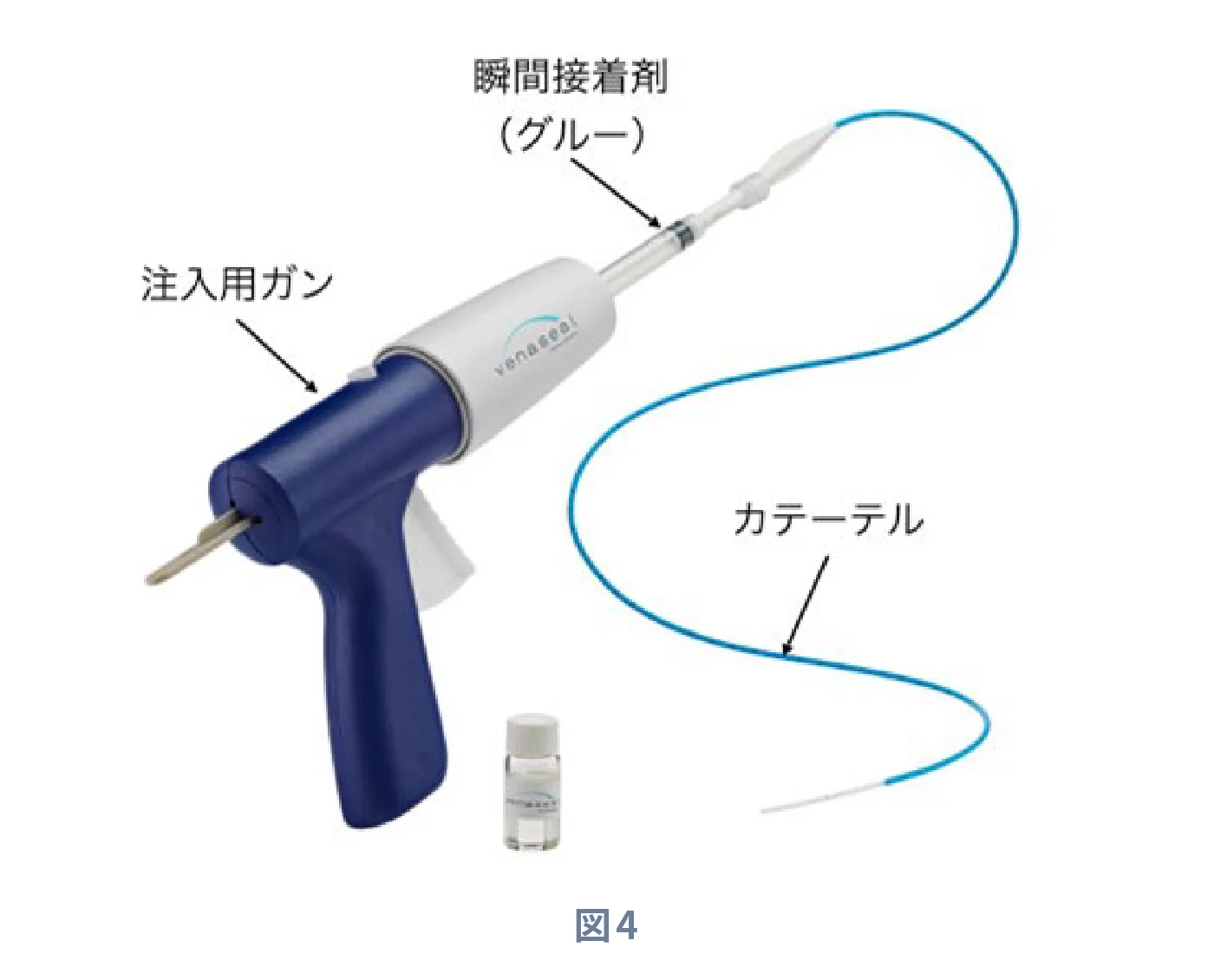 B. 血管内塞栓術 (医療用接着剤(グルー治療))