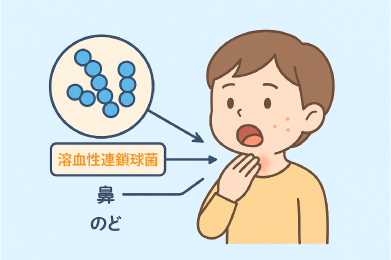 溶連菌感染症とは
