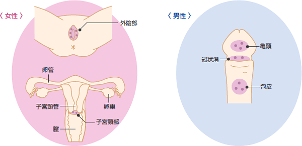 性器ヘルペスの原因って?