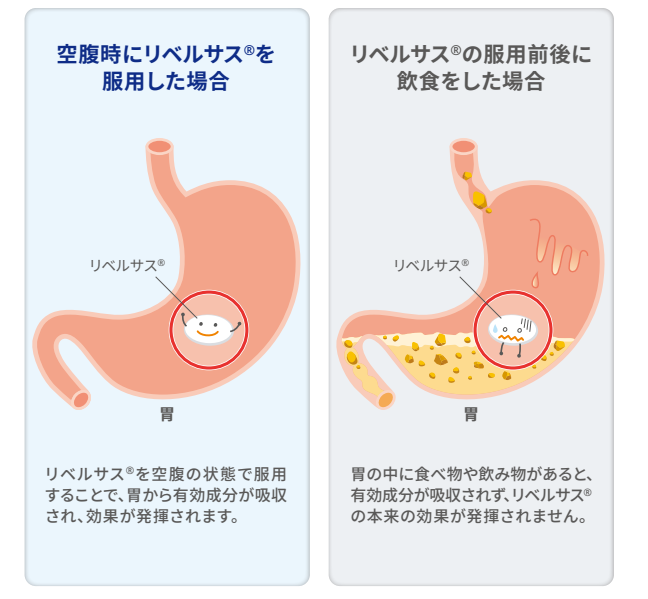 リベルサスとは