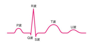心電図