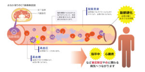 内臓脂肪が蓄積すると…